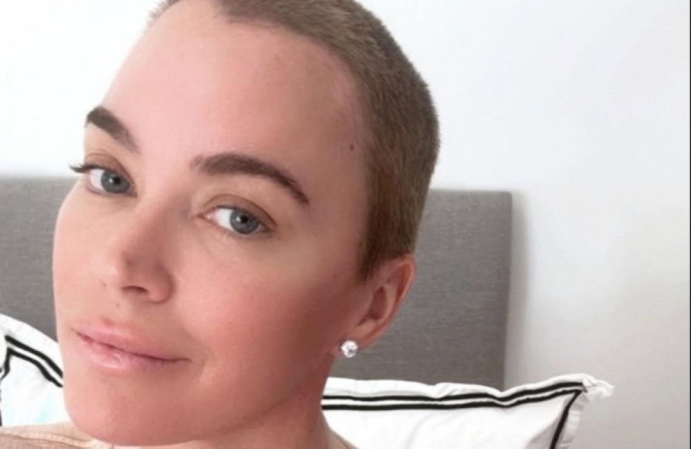 Teddi Mellencamp sieht ‚deutliche Veränderung‘ ihres Haarwuchses nach Krebsbehandlung