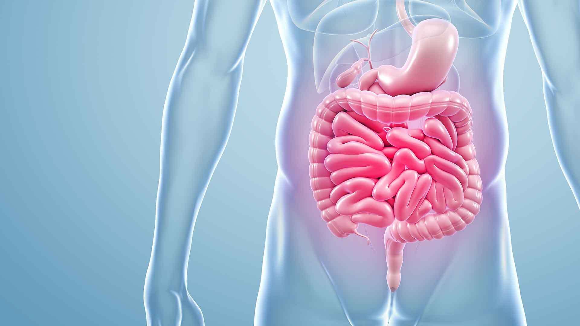 Intestinal obstruction: typical symptoms of ileus