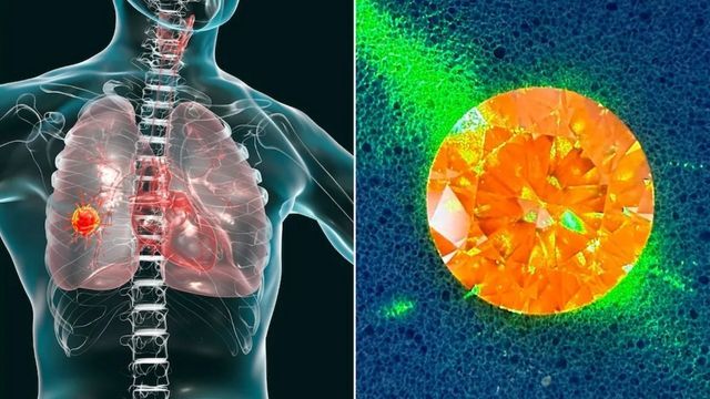 Ein Diamant-Sensor ist die neue „Gamechanger“-Hoffnung im Kampf gegen Krebs