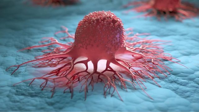 Video: Verheiratete bekommen seltener Krebs – vor allem 2 Arten