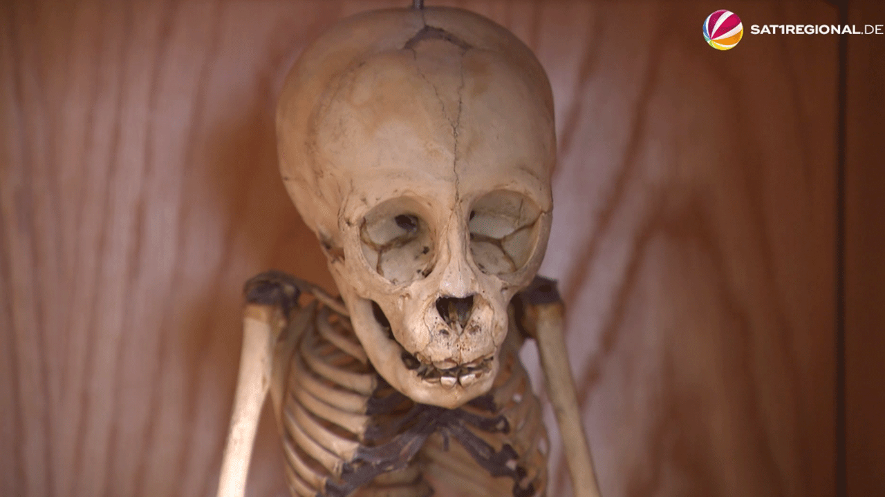 Video: Sammlung der Anthropologie der Georg-August-Universität steht vor dem Aus