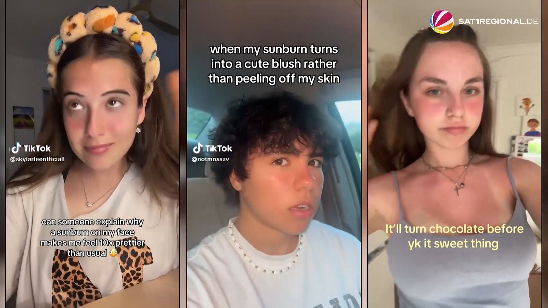 Video: Sonnenbrand als TikTok-Trend? Hautärzte warnen vor "Sweet Sunburn" & Co.