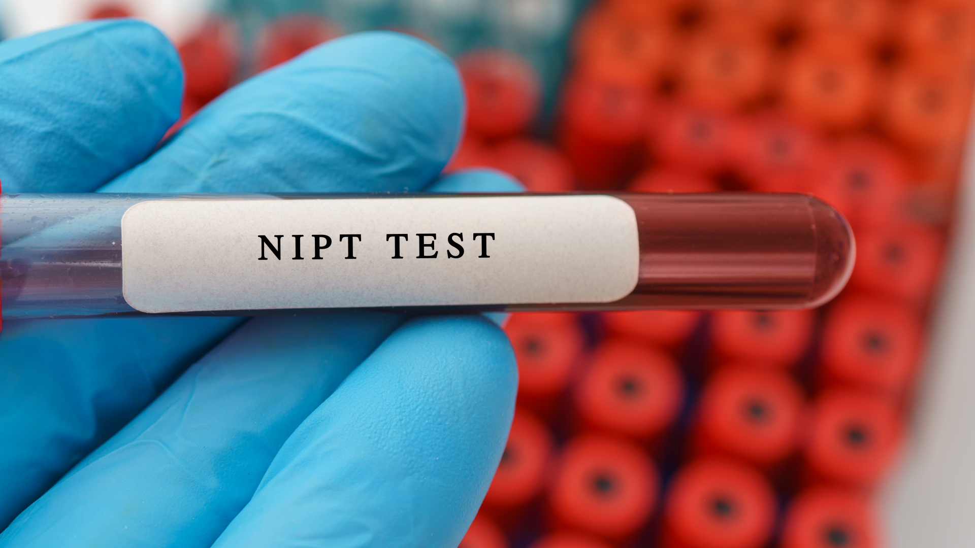 Video: Wie sinnvoll ist der NIPT-Bluttest?